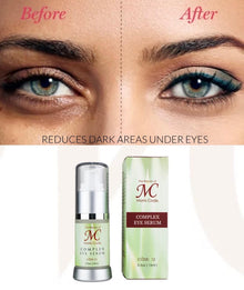 Complex Eye Serum