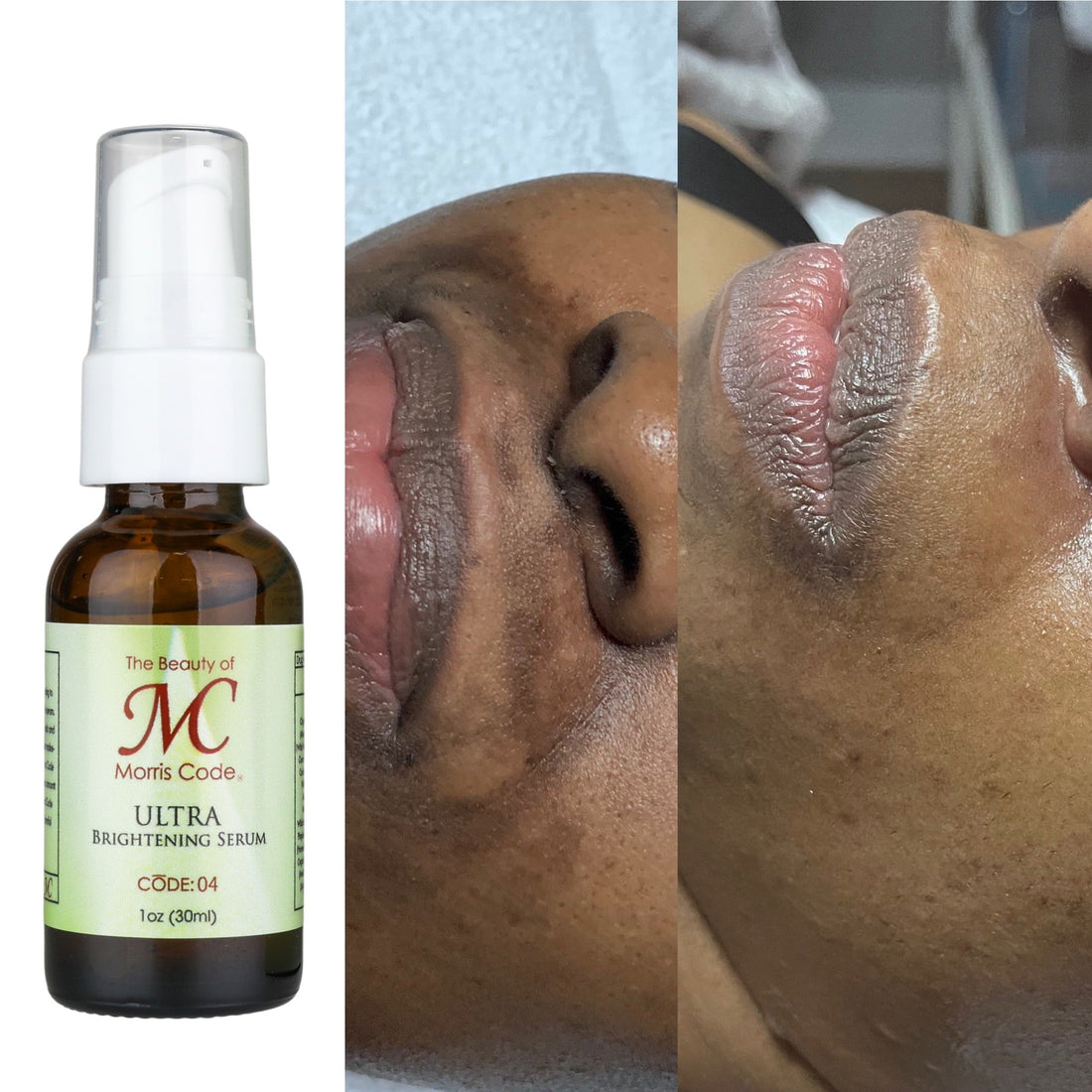 Ultra Brightening Serum